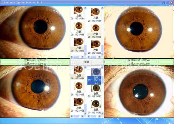 虹膜怎么采集（虹膜怎么采集的）-第1张图片-安保之家